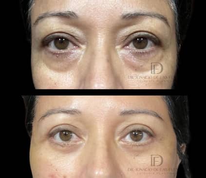 Slider image (8) Dr. Ignacio De Las Fuentes